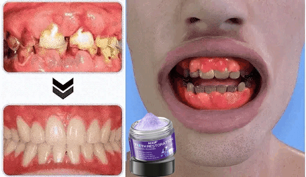 Limited Time Offer 🚨AEXZR® Teeth Restoration Mineral Powder – Only 50 in stock available! Act Fast!