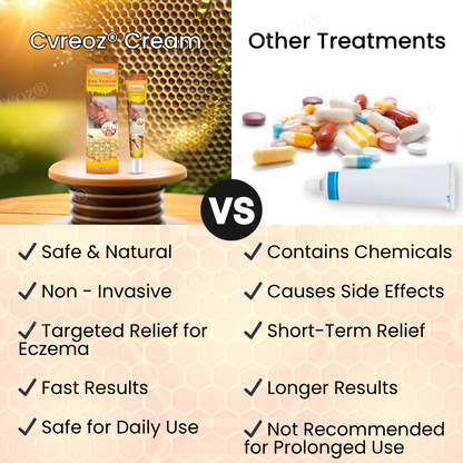 Cvreoz® Bee Venom Psoriasis Cream