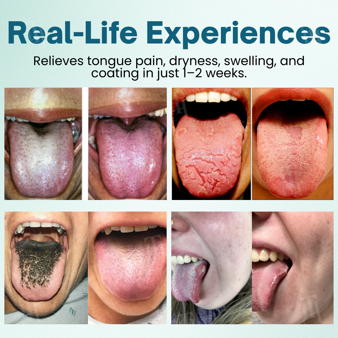 Piguiay® ProShield Tongue Restore Spray✅ 𝐏𝐫𝐨𝐯𝐢𝐝𝐞𝐬 𝐫𝐞𝐥𝐢𝐞𝐟 𝐢𝐧 𝐣𝐮𝐬𝐭 𝟑 𝐦𝐢𝐧𝐮𝐭𝐞𝐬