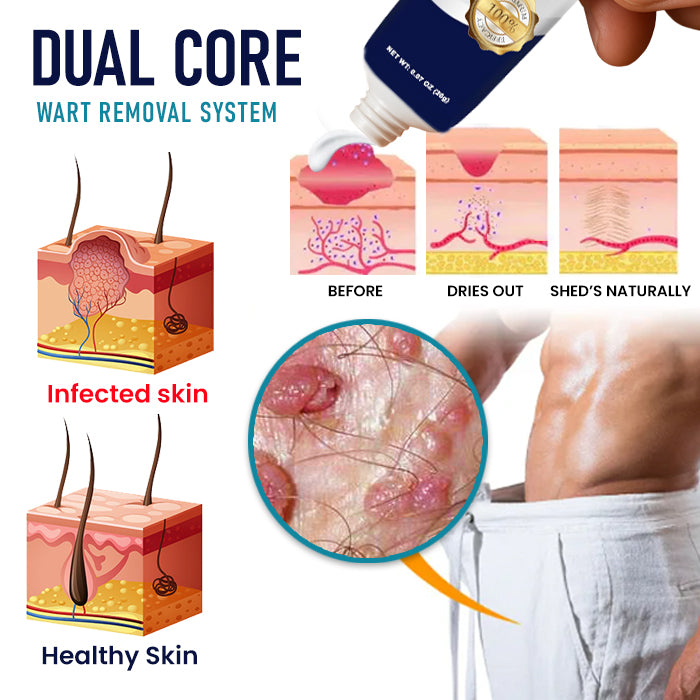 Cvreoz® Genital Warts Remover Cream