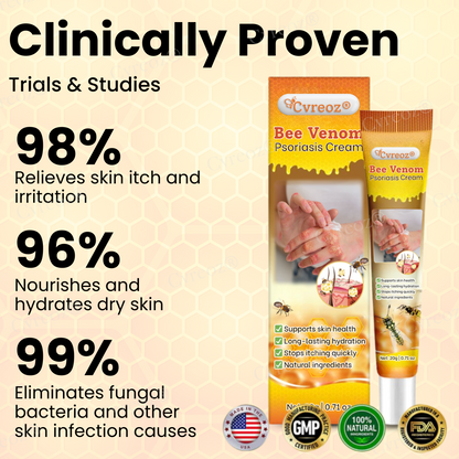 Cvreoz® Bee Venom Psoriasis Cream