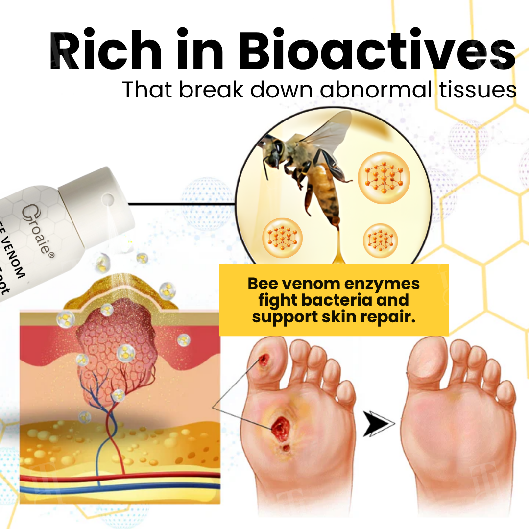 Croaie® Bee Venom Diabetic Foot Ulcer Spray ✅ 𝐕𝐢𝐬𝐢𝐛𝐥𝐞 𝐢𝐦𝐩𝐫𝐨𝐯𝐞𝐦𝐞𝐧𝐭 𝐢𝐧 𝟐-𝟑 𝐰𝐞𝐞𝐤𝐬✅
