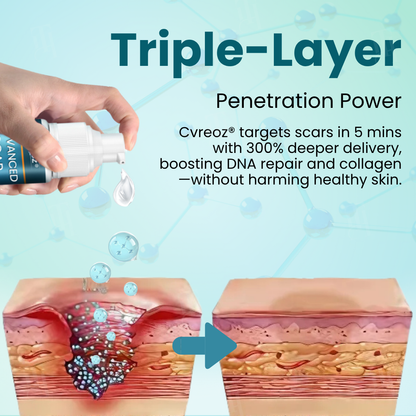Cvreoz® Advanced Scar Gel