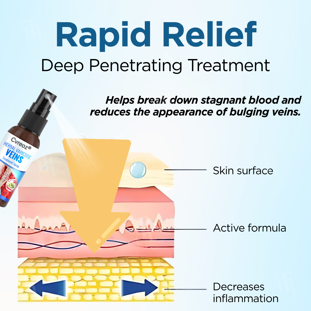 Cvreoz® Herbal Varicose Veins Treatment Spray