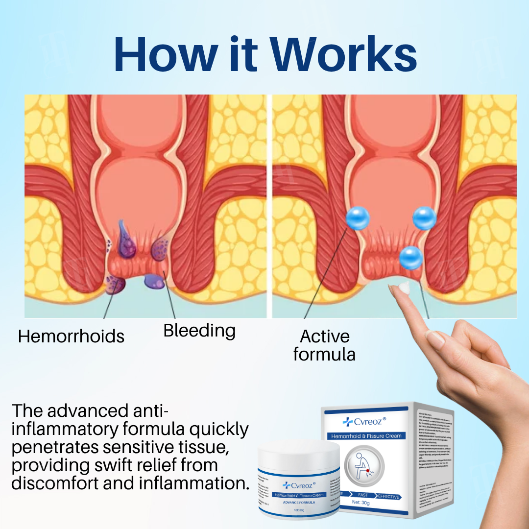 🏷️ EXCLUSIVE DEAL! 50% OFF - Cvreoz® Hemorrhoid & Fissure Cream