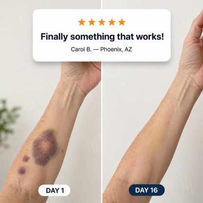 📢 16 orders left!! | AEXZR® Bruise Repair + SPF 30 Skin-Strengthening Cream