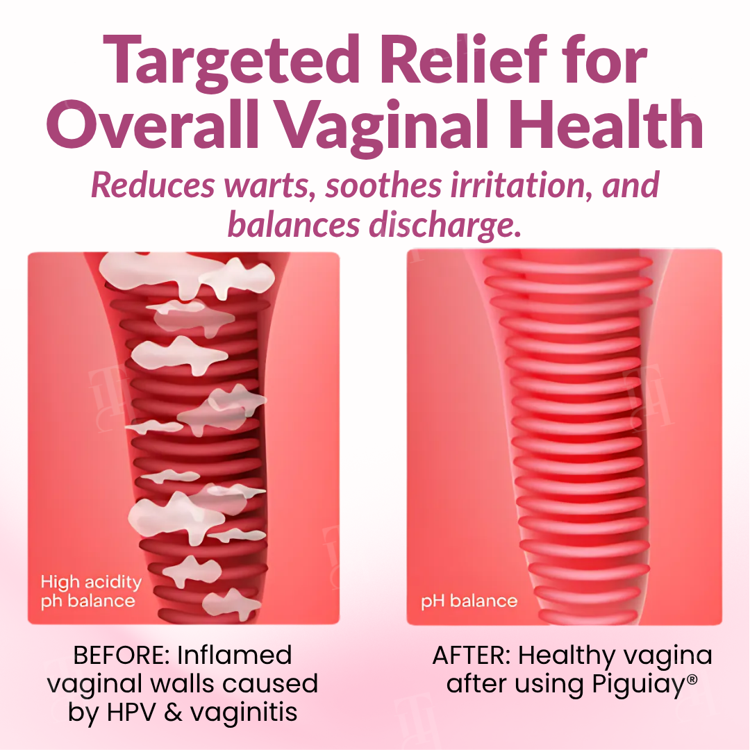 Piguiay® Femina HPV Relief Capsules ✨𝐄𝐟𝐟𝐞𝐜𝐭𝐢𝐯𝐞 𝐑𝐞𝐥𝐢𝐞𝐟 𝐟𝐫𝐨𝐦 𝐇𝐏𝐕 𝐒𝐲𝐦𝐩𝐭𝐨𝐦𝐬✨