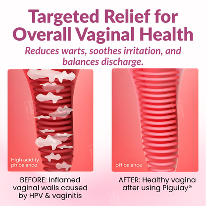 Piguiay® Femina HPV Relief Capsules ✨𝐄𝐟𝐟𝐞𝐜𝐭𝐢𝐯𝐞 𝐑𝐞𝐥𝐢𝐞𝐟 𝐟𝐫𝐨𝐦 𝐇𝐏𝐕 𝐒𝐲𝐦𝐩𝐭𝐨𝐦𝐬✨